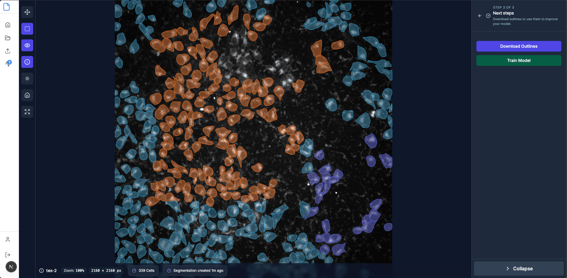 Cell segmentation visualization showing multi-class analysis with different cell types
